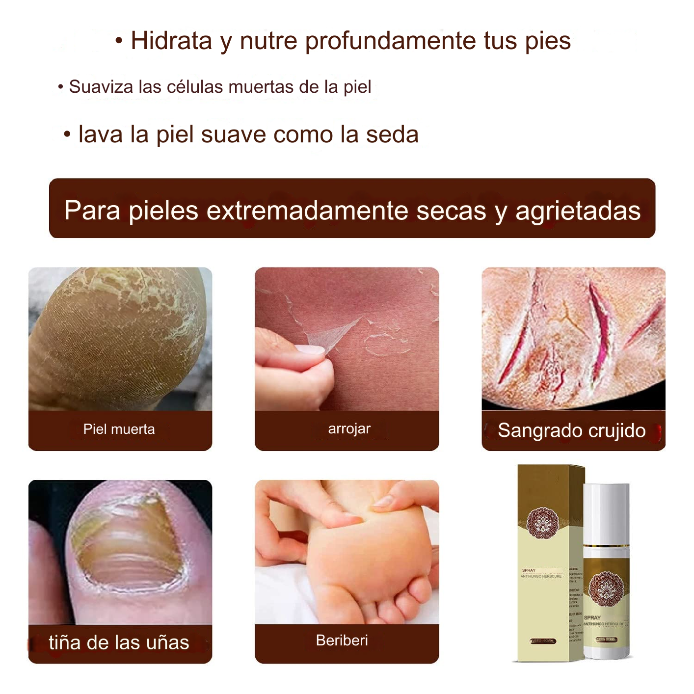 SPRAY PARA HONGOS Y MAL OLOR EN LOS PIES